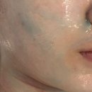 전포동피부관리 스킨올서면전포점 부산결혼준비 스페셜케어와 함께 샤이니터치 후기 광채피부만들기