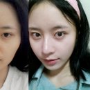 [★윤양클럽 성형비용할인/공동수술이벤트★] 파격적인 성형비용 할인과 스페셜 혜택이 돌아왔쇼! 이미지