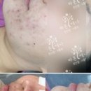 닥터라온제나