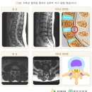 우리신경외과우리웰빙