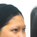 슈어스성형외과의원 이미지