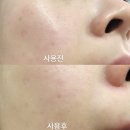 컬러인스킨