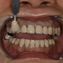 디지털(DIGITAL) 치과기공소 이미지