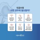 수정-7 이미지