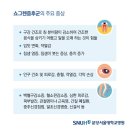 [생생건강정보]건선·뺨 발진도 '자가면역질환'…면역세포의 공격, 왜? 이미지