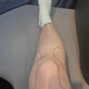 운정척신경외과의원 네이버블로그