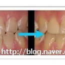 해맑은 치과의원 이미지