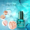 구억리네일쌀롱 | 파고드는발톱은 관리가 중요하죠~ 발톱교정은 페디아이티엔에서 알아보세요!