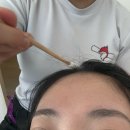 헤어토픽 | 대구 범어 두피탈모 전문센터 해솔두피클리닉스에서 두피관리 받은 후기