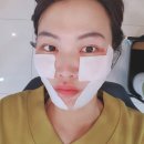 영등포피부과 피부관리 차 맞은 샤넬주사 후기 가격 착해서 두번 맞을 수 있어요