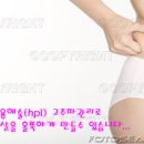 다이어트-의학적 보조요법들…지방제거 단기효과…운동 병행해야 이미지