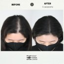 스칼프디자인센터 의정부점 이미지