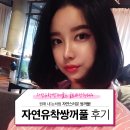 두란이네상점 | 자연유착쌍꺼풀후기 궁금하다면