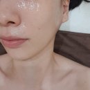 목동 피부관리는 여기로 정착 :: 달라에스테틱 솔직 후기 (등촌역 에스테틱 추천)
