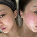 씨유김해장유삼문점 | 김해 장유 에스테틱 내돈내산 추천 엘리유스킨 엑스터 레이저