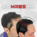 광주두피문신 후기모음, 정수리부터 M자이마, 가르마까지 전후사진으로 비교해보세요