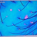 바른인한의원 이미지