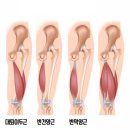 파워 스트레칭 이미지