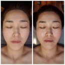 강릉 피부샵 추천 The쉼 스킨앤바디 물방울리프팅 후기
