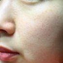 빅스메디 이미지