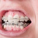 이턱퍼스트치과의원 이미지