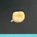 오션기공소 이미지