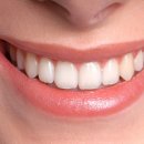 뿌리심는치과의원 이미지