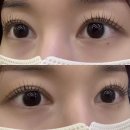 금천구 속눈썹펌 엘로이뷰티 쌍수 후 솔직후기