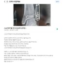 ★이용후기-광주재활운동-발목 골절 수술 후 빠른...정답!! -수완-첨단지구-장덕-신창-신가동 재활운동