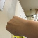새롬의료재단 | 원인불명 만성 콜린성, 접촉성 두드러기 치료후기(1)
