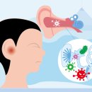 밝은귀 독일 보청기 이미지