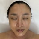 성남대로171번길 | 자꾸만 셀카를 찍고 싶어지네, 분당윤곽관리 에르모소쌀롯