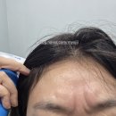 지축 다시봄날에서 가다실 3차와 보톡스
