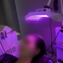 웅신프라자 | 일산 두피 스케일링 추천 웰킨 두피탈모센터 정발산역점 추천 후기