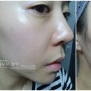 인셀덤빛나라