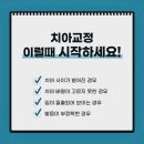 애니얼라인 이미지