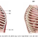 영짐 이미지