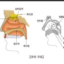 코골이는 아주 위험한 병인지 궁금하시죠. 이미지