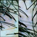 수원-0264 | 수원 탈모관리, 가본 곳 중 최고였던 두피관리샵 : 숲칼프 수원호매실점 후기