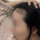 트리코닉스트리코엑스두피 앰플, 시원한 탈모 앰플 홈케어 후기