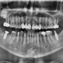 보일치과기공소 이미지