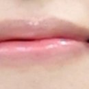최*건 | [우당탕탕 새신부] 결혼식 피부관리_😢최최종 후기😢