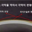 비전앤하드렌즈샵