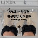 신포동왁싱 추천 헤어라인왁싱 잘하는 집 린다뷰티 솔직후기