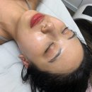 의정부피부관리 아티스트비에스 스킨플래닝 솔직후기