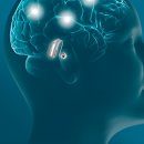 오티콘보청기 이미지