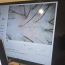 케어존 | 부산 동래구 탈모케어존 방문 후기 내 두피가 달라졌어요!