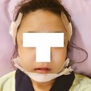 윤곽
