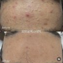 오브유에스테틱