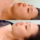보스마린 | 해운대 피부관리 마린시티 윤곽관리 광안리 예신관리 에스테티아